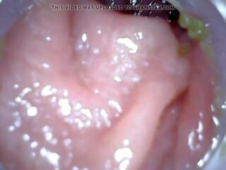 アナル endoscope パート 1, フリー 浣腸 罰 高解像度の セックス ビデオ 04